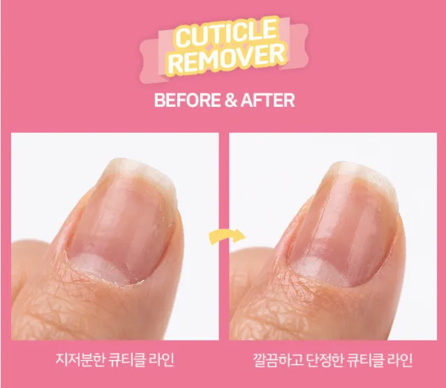 ABLLIZ Cuticle Remover