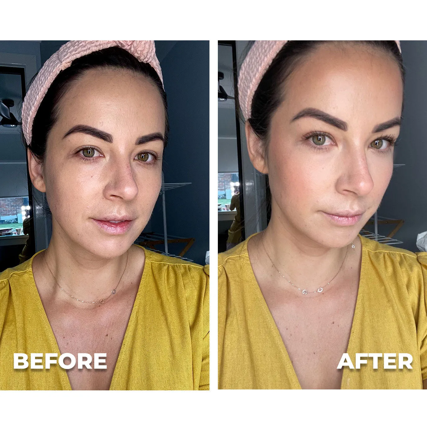 Anti-Acne Spot Cream   Free Concealer (Zit Kit)