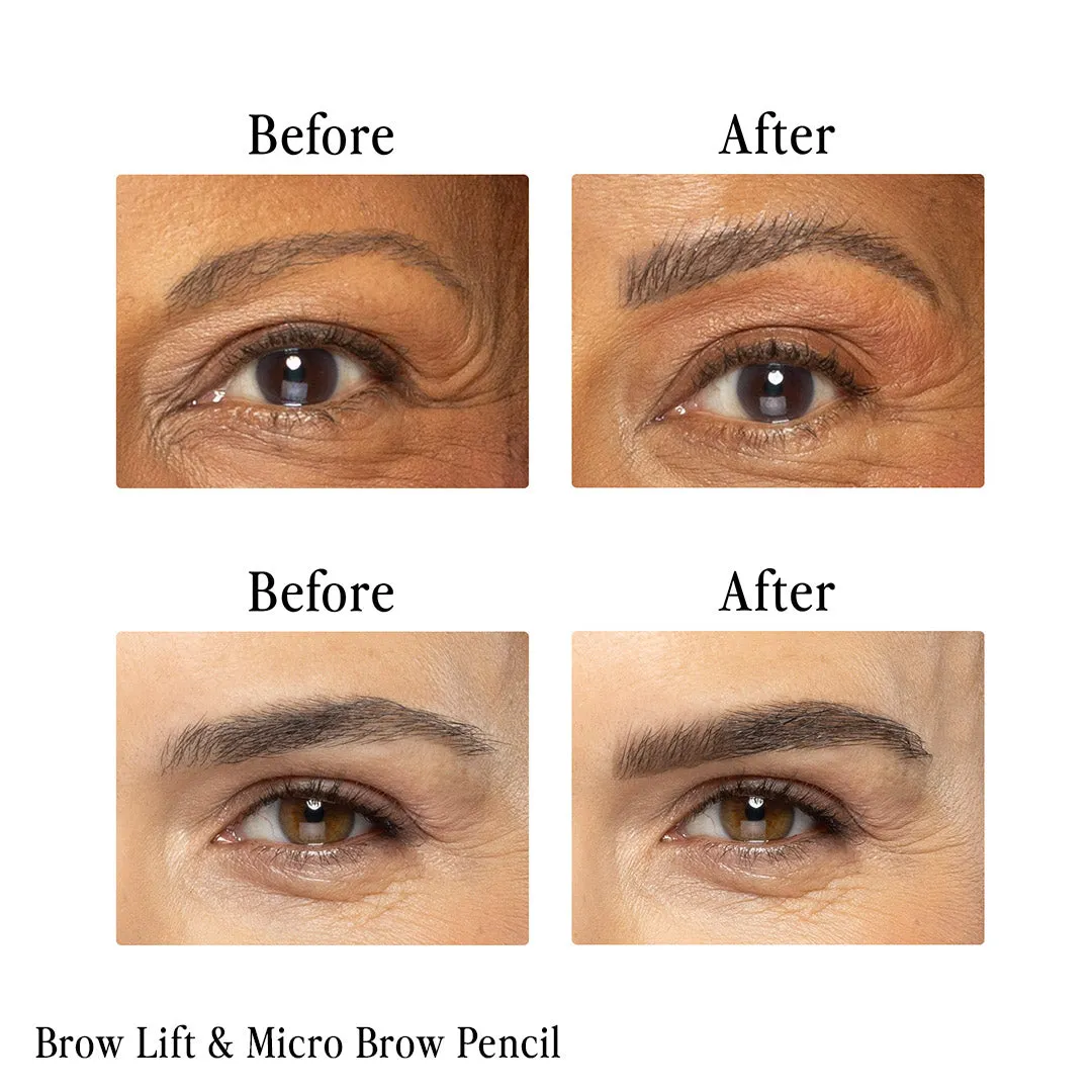 Billion Dollar Brow Lift Kit