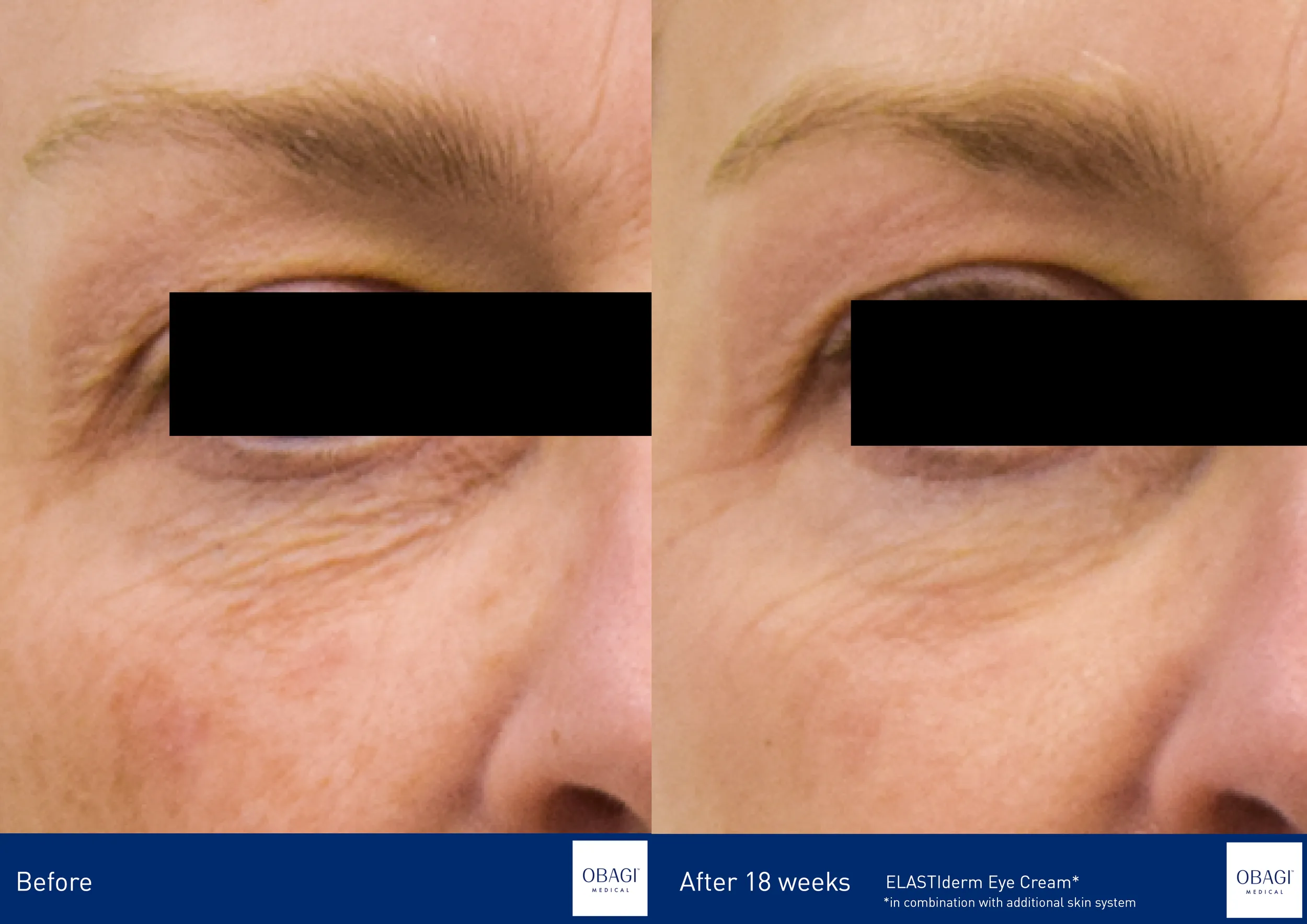 ELASTIderm Eye Cream