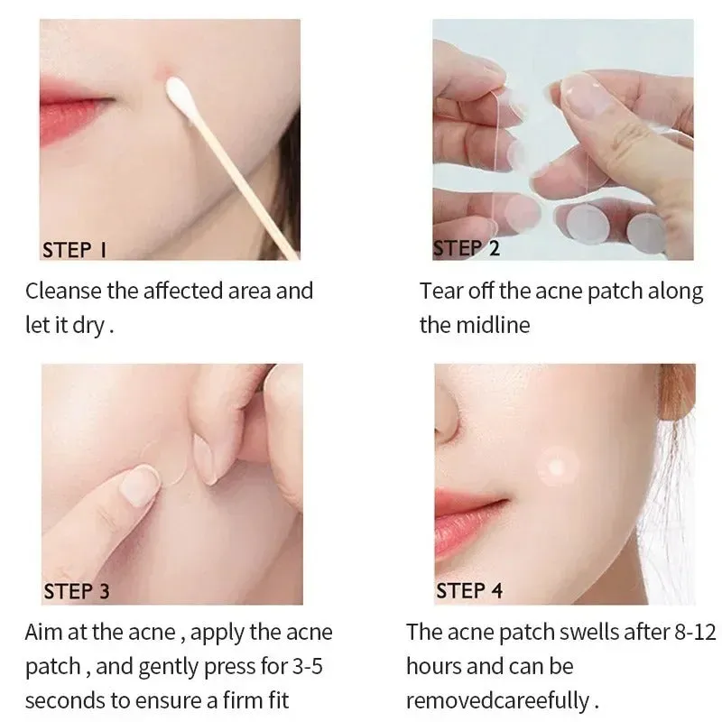 Invisible Acne Patches - Removal Pimple Anti-Acne Hydrocolloid Patches - Spots Marks Concealer Repair